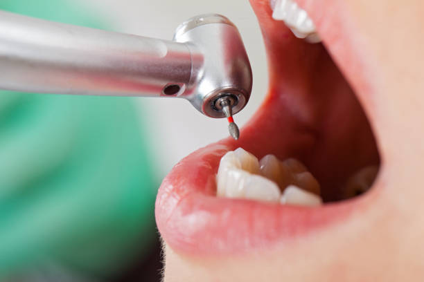 Best Tooth Pain Emergency Relief  in Denham Springs, LA